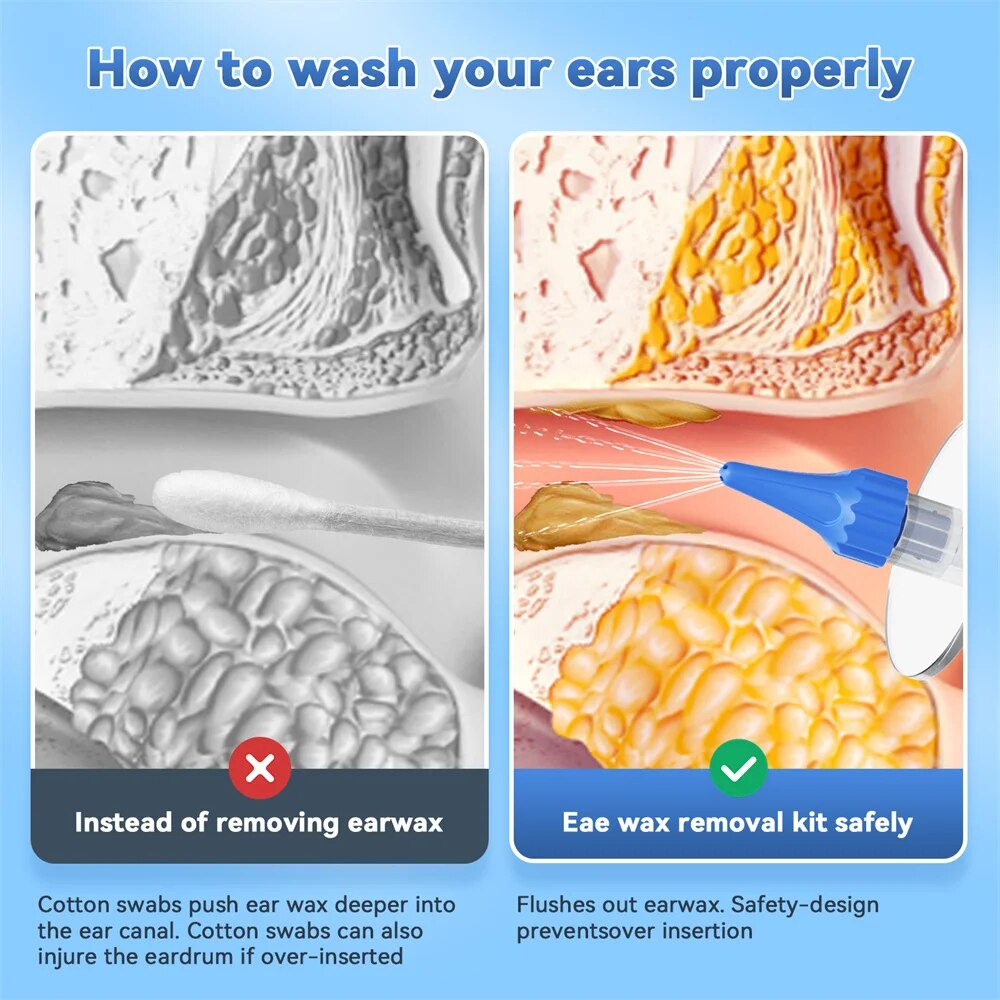 EAR WAX Removal คู่มือทําความส - Smart Garden Watering System บทวิจารณ์และราคา